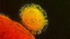 Transmission electron micrograph of novel coronavirus. (NIAID/RML)