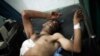 In this Wednesday, Sept. 19, 2012 photo, a man lies in the hospital after being shot by a Syrian Army sniper near his home in Aleppo, Syria. (AP Photo/Manu Brabo)