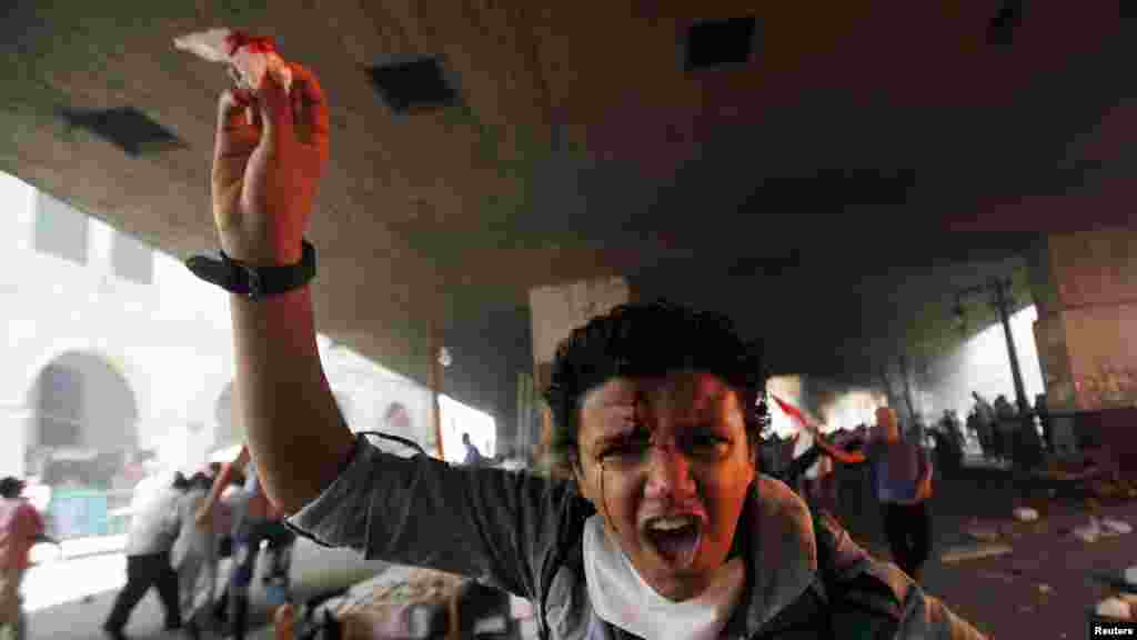 A member of the Muslim Brotherhood and supporter of ousted Egyptian President Mohamed Morsi shouts slogans after he is injured in front Azbkya police station during clashes at Ramses Square, Cairo, August 16, 2013.
